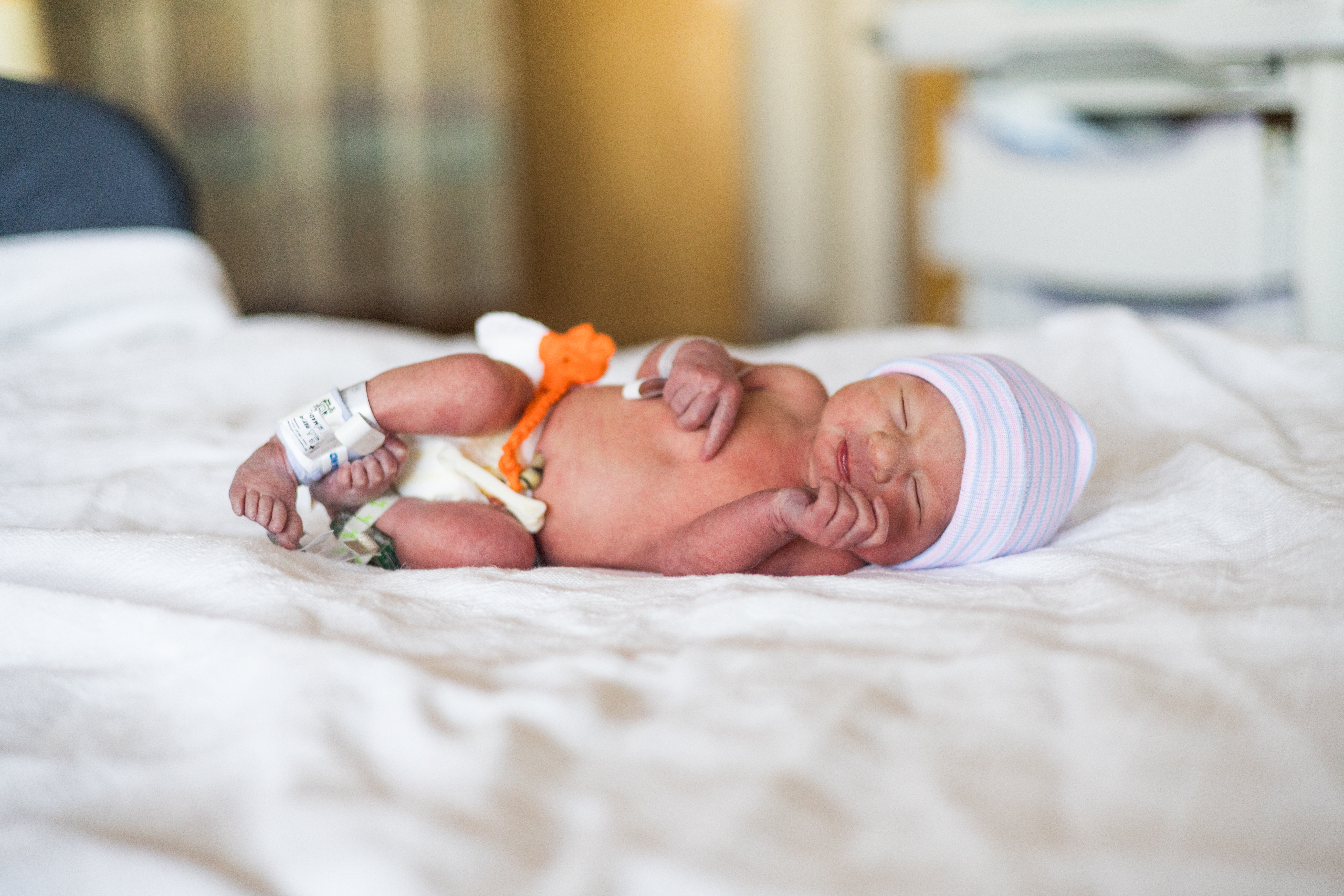 A newborn baby, likely a boy, lying down, with diaphanous flesh, and with a primarily pink and blue striped hat or cap on ...
